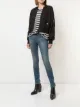Image 2 of R13 Alison skinny jeans