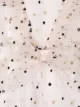 Philosophy Di Lorenzo Serafini Kids embroidered polka-dot tulle dress