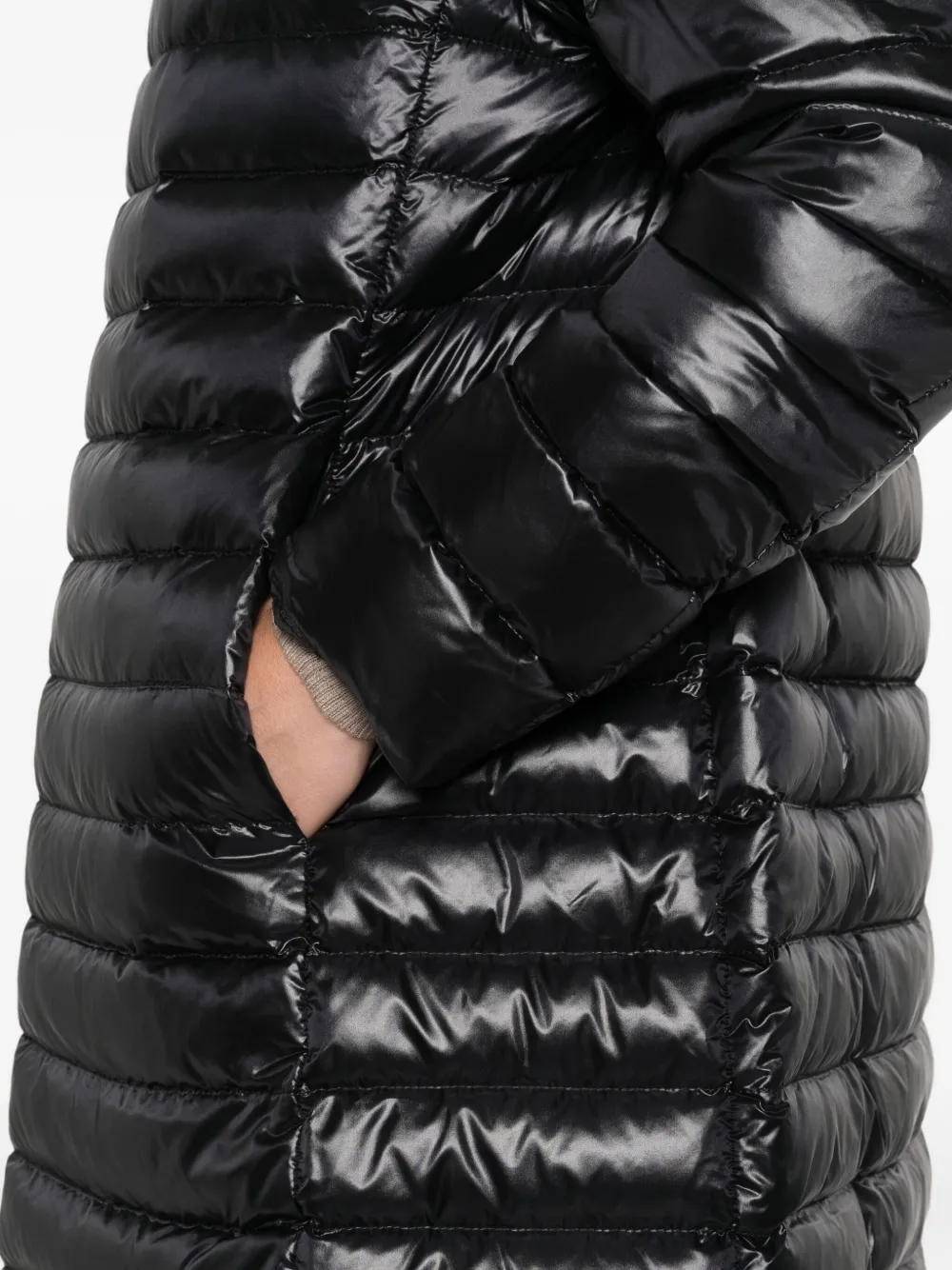 Detachable-Liner Coat
