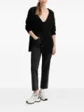 Silvian Heach buttoned-front cardigan - Black
