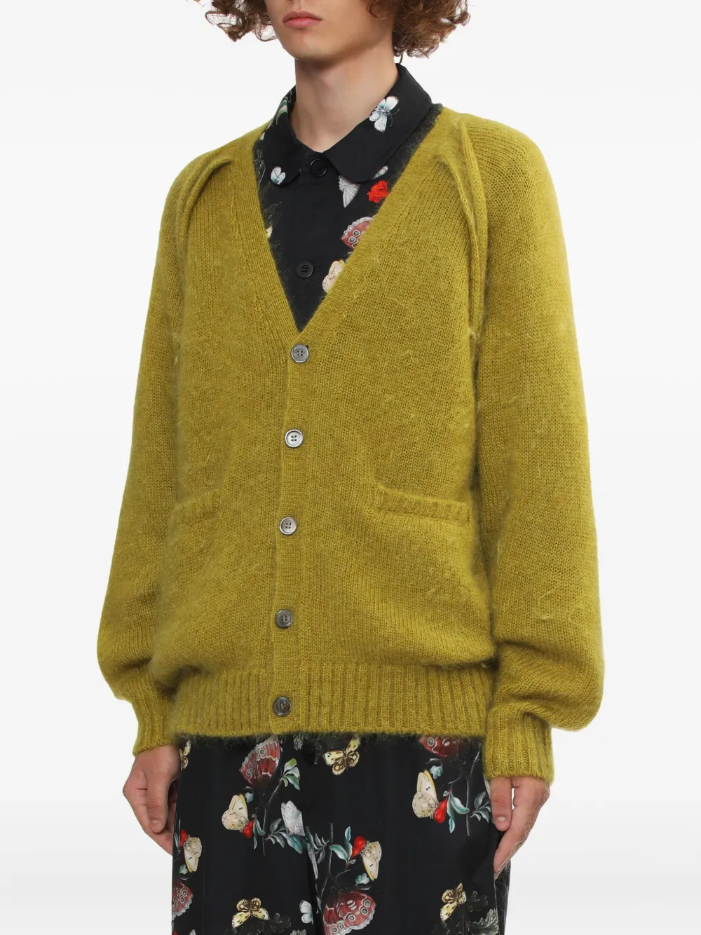 Undercover Patch Pocket V-neck Cardigan In Yellow