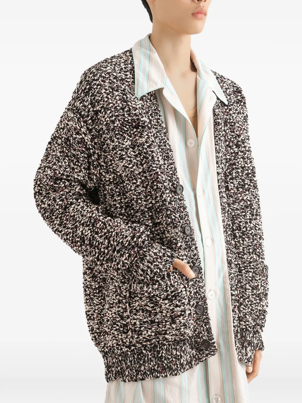 Dolce & Gabbana Katoenen vest Zwart