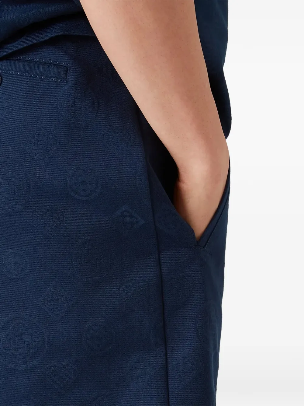 pattern-detail shorts