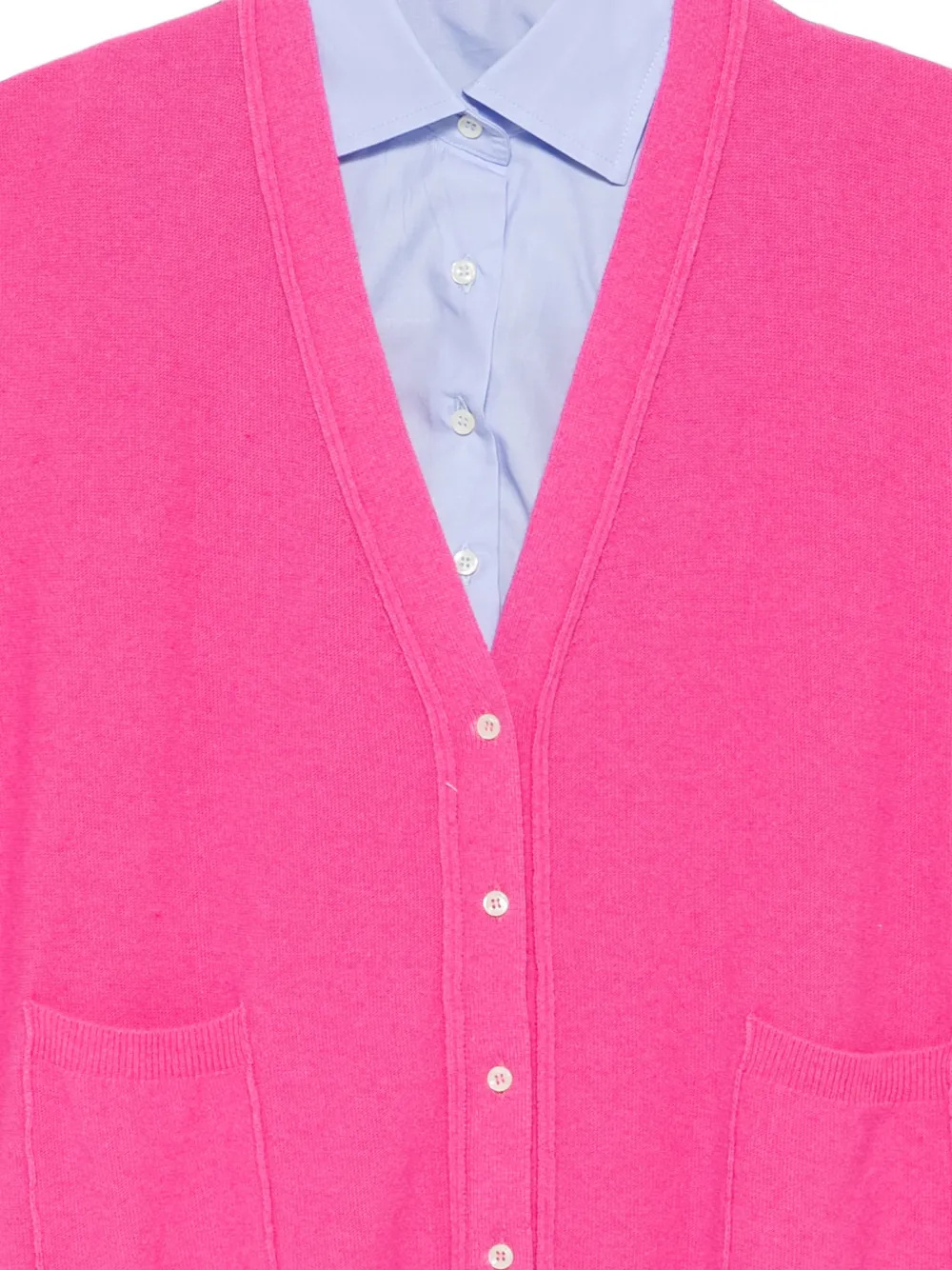 Jejia Button-up gilet Roze