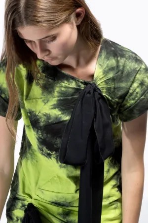 tie-dye dress